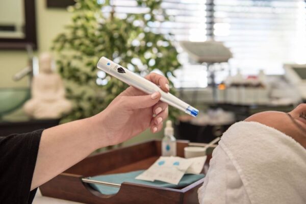 WandPro: בדקנו מה עומד מאחורי עט הפלא הקוסמטי